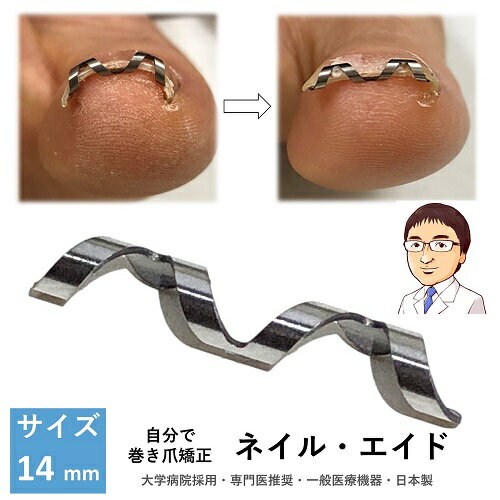 巻き爪 自分で 巻き爪矯正 【 ネイル・エイド 14mm 】 クリップ ワイヤー ガード 痛い巻き爪 ブロック テープ ロボ 靴 やすり くい こまーぬ 巻爪 対策 ゲル 治療 器具 矯正器 介護 グッズ 自宅 テーピング【14mm】